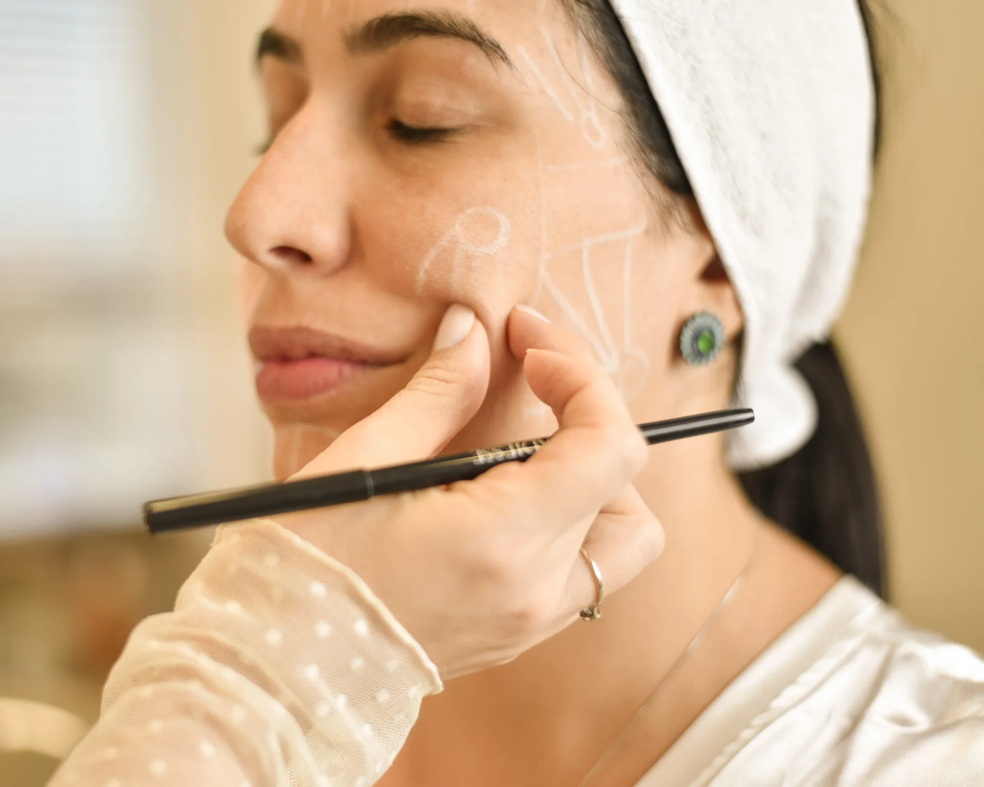 Tratamento para Flacidez - A flacidez facial envolve perda progressiva de firmeza e sustentação. Conheça tratamentos dermatológicos personalizados para o contorno facial em Uberlândia.